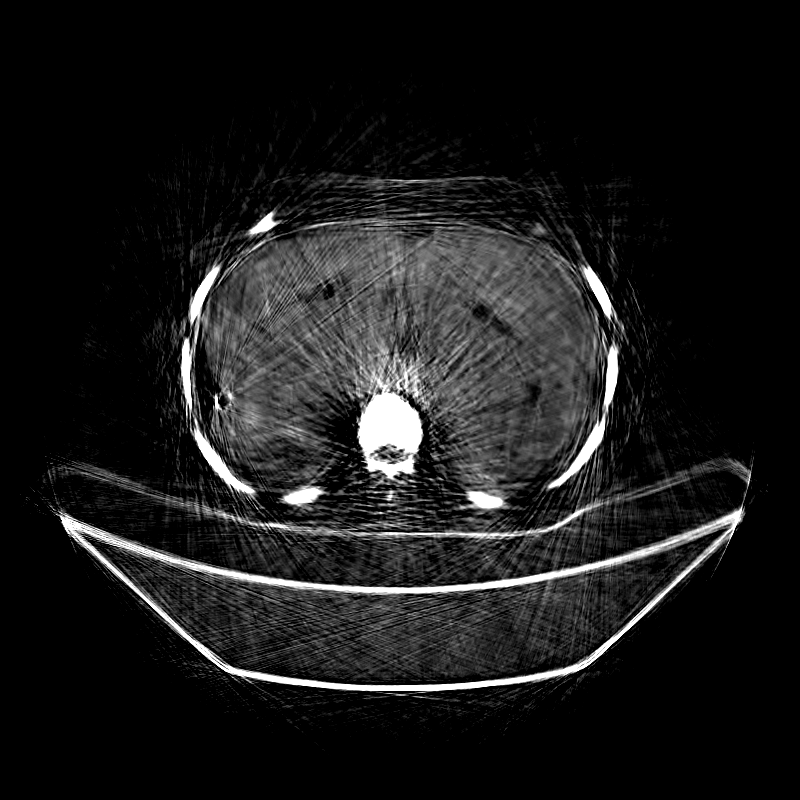 SONAR Phase Retrieval